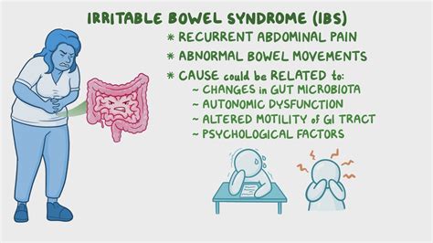 Irritable Bowel Syndrome Clinical Sciences Osmosis Video Library