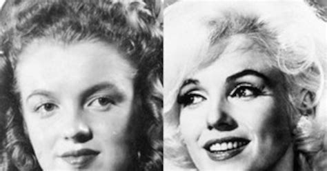 Marilyn Monroes Medical Records And X Rays Confirm Plastic Surgery