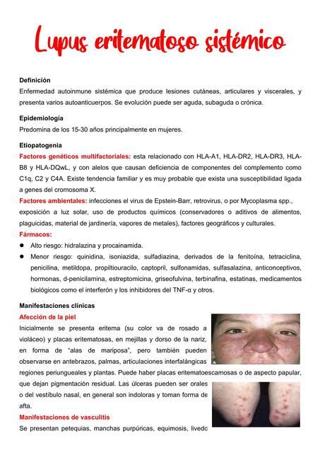 Lupus Eritematoso Sistémico Apuntesmedicina Udocz