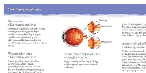 Glaucoma Brochure Ojibwe The Canadian Association Of Optometrists