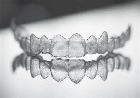 What Are The Results And Benefits Of Clear Braces In Mississauga