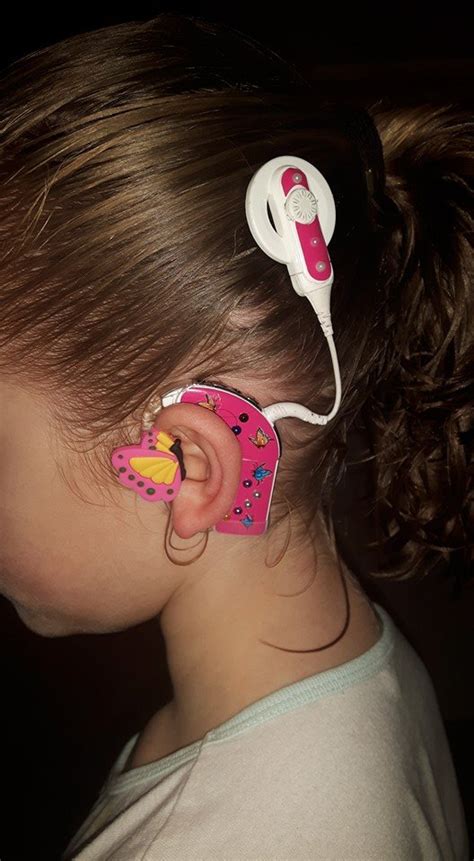 Mom Creates Brilliant Way To Help Kids With Hearing Aids Feel Confident