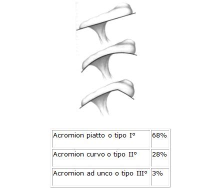 The acromion is a small section of the scapula which extends anteriorly from the spine of the scapula and the acromial angle (aa) is a prominent bony point at the junction of the lateral border of the. SINDROME DA CONFLITTO SUB-ACROMIALE DI SPALLA: CONFRONTO ...
