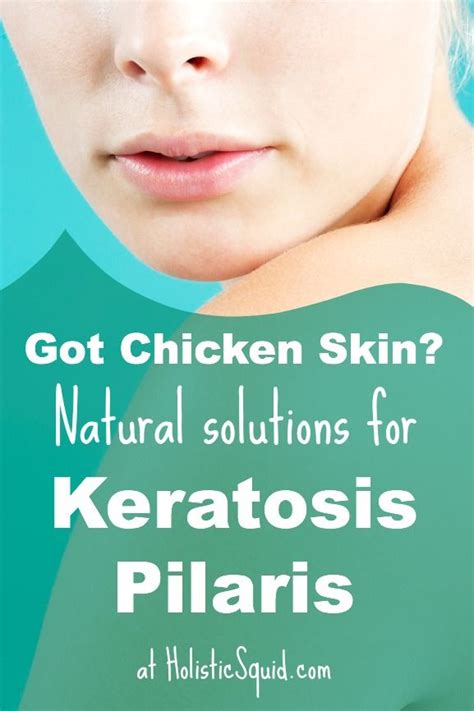 How To Treat Keratosis Pilaris Naturally Holistic Squid Keratosis
