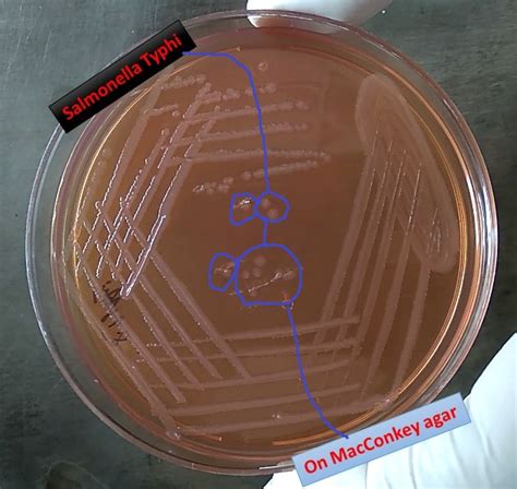 Salmonella enterica serovar typhi, the cause of typhoid, is host restricted to humans. Salmonella on MacConkey agar and its Pathogenecity ...