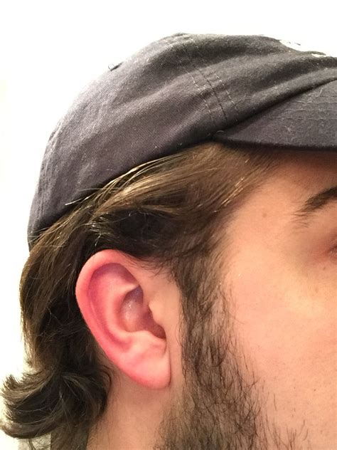 How Do I Deal With These Wispy Bits Of Hair Rmalehairadvice