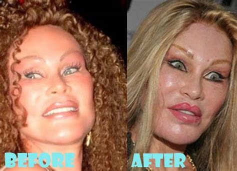 Jocelyn Wildenstein Plastic Surgery Before And After Photos Lovely