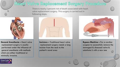 Ppt Heart Valve Replacement Surgery Procedure Powerpoint Presentation Id 7656897