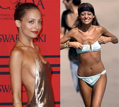 Pictures Celebrities Who Had Eating Disorders Nicole Richie
