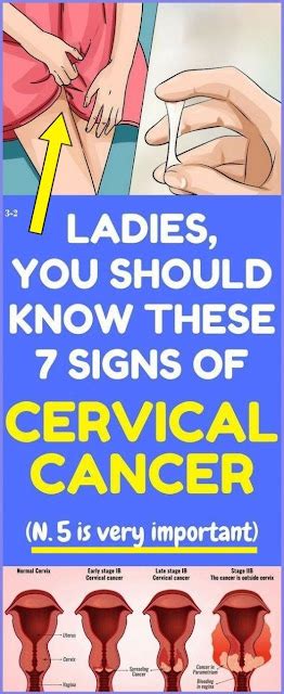 7 Warning Symptoms Of Cervical Cancer That Every Women Should Know Medicine Health Life