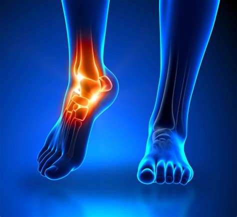 Ankle Pain Causes And Treatment Northeast Spine And Sports Medicine
