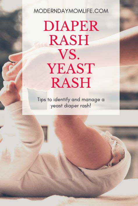 Yeast Diaper Rash And Diaper Rash Prevent Any Prolonged Suffering