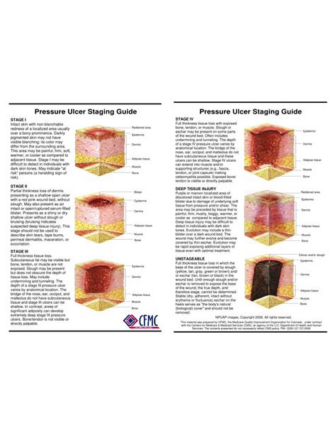 Pdf Staging Guide 092208 Ulcer Staging Guide Pressure Ulcer Staging Guide Stage Iv