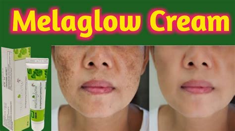 Melaglow Cream Uses And Side Effects👍 Youtube