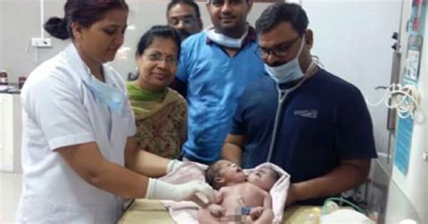 First Time Mom Faints After Giving Birth To Baby That Has Two Heads
