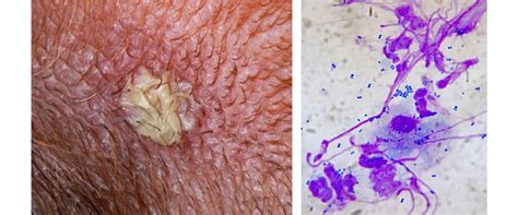 Bacterial Folliculitis Pyoderma In Dogs Home Treatment