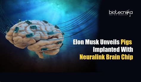 Neuralink Brain Implant Elon Musk Unveils Pig With Computer Chip In