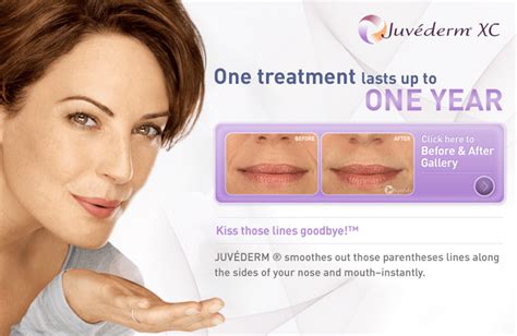 Which Juvederm Filler Is Best For Specific Facial Areas Dallas Plano