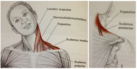 Neck And Shoulder Stretching Posture Brace Pro Shoulder Anatomy