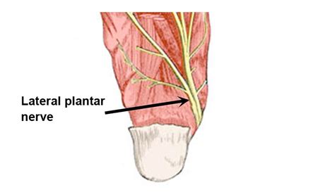Lateral Plantar Nerve Entrapment Symptoms Causes And Treatment
