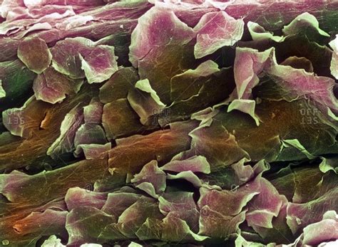 Human Dead Skin Cells Under Microscope Micropedia