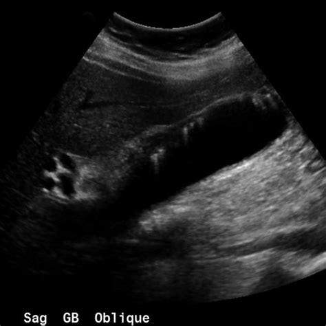Pin On Ultrasound Student