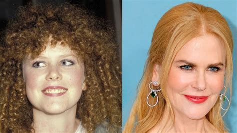 Nicole Kidmans Plastic Surgery The Northman Stars Transformation