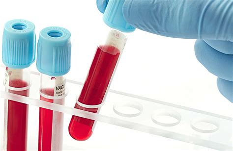 5 min read november 24, 2017. abo blood type discovery