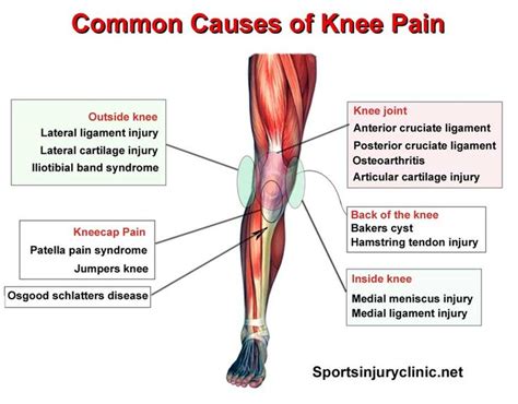 Where Is Your Knee Pain And What Could Be Causing It These Are The