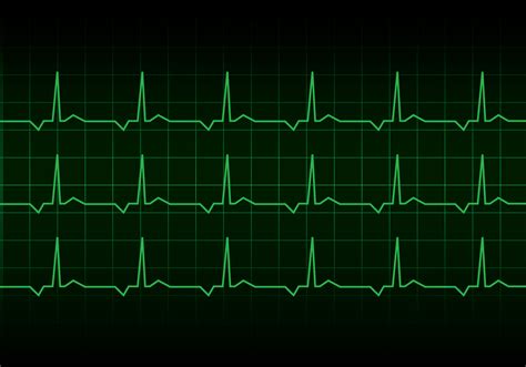 Heartbeat Heart Rhythm Monitor Vector 180614 Vector Art At Vecteezy