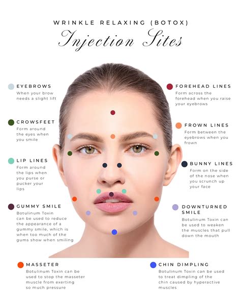 Botox Injection Sites Face Everything You Need To Know Aesthetics By Stephanie Livingston