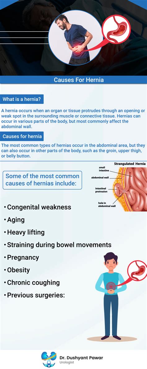 What Is Causes Of Hernia Types Symptoms Treatment
