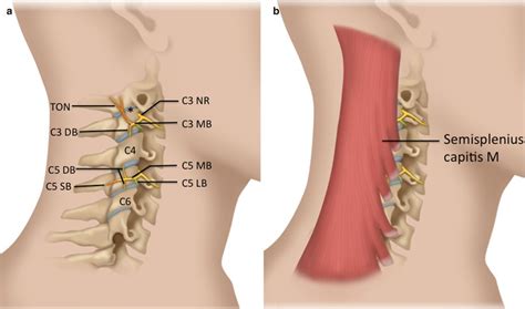 Ultrasound Guided Cervical Facet Nerve Blocks Medial Branch And Third
