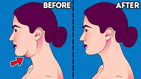 Face Fat How To Lose Face Fat Facial Exercises For Double Chin Youtube