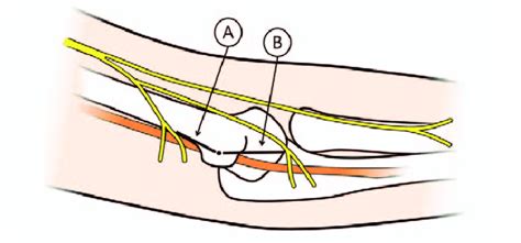 Medial Antebrachial Cutaneous Nerve Branches Were Measured In