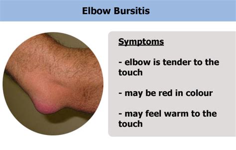 6 Causes Of Why Your Elbow Is Tender To The Touch With Pics