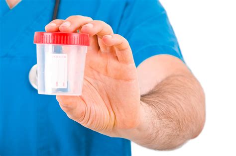 The alcohol use disorder identification test: Urine alcohol tests: How long can they detect drinking ...
