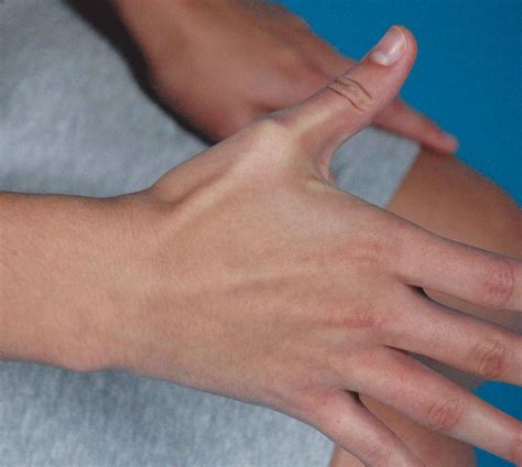 The Forearm Wrist And Hand Musculoskeletal Key