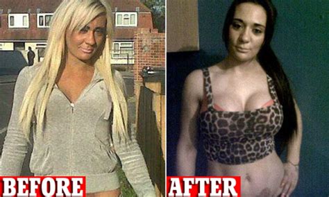 model josie cunningham s £4 800 breast op and you foot the bill outrage as the nhs provides