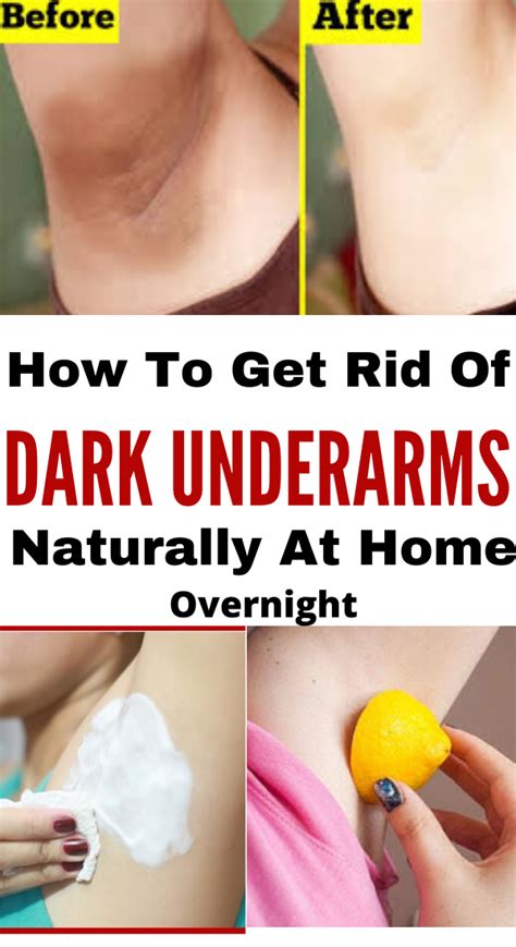 Dark Underarms Remedy How To Whiten Underarms Whitening Underarms How To Lighten Armpits