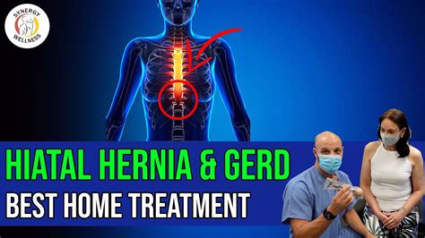 Best Hiatal Hernia GERD Home Treatment YouTube
