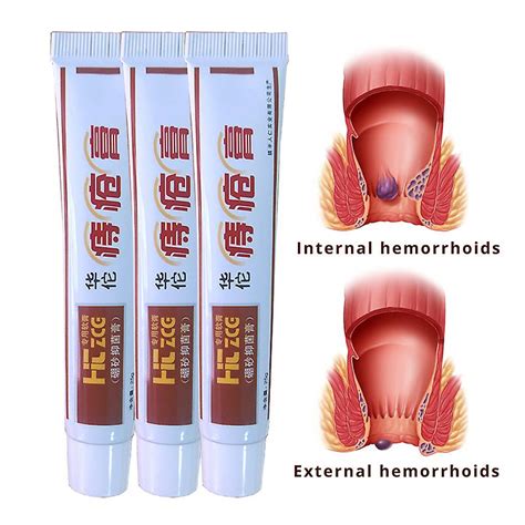 hemorrhoids ointment plant herbal materials powerful hemorrhoids cream internal hemorrhoids