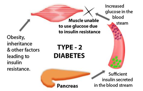 Type 2 Diabetes The Danii Foundation