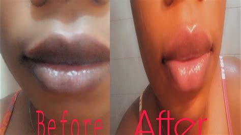 How To Brighten Dark Lips Naturally At Home And Get Pink Lips Youtube