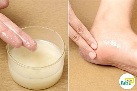 How To Heal Dry Cracked Heels Quickly With Home Remedies