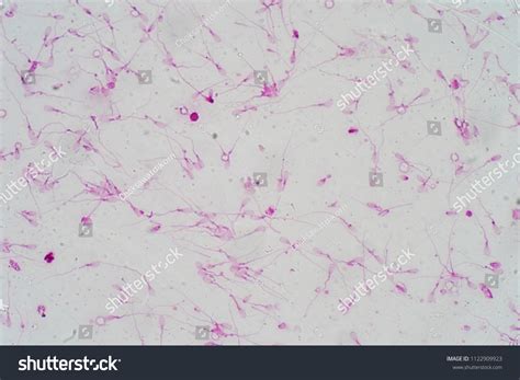 human sperm morphology under microscope micrograph foto stock editar agora 1122909923