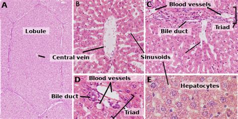 Liver Histology Model Labeled