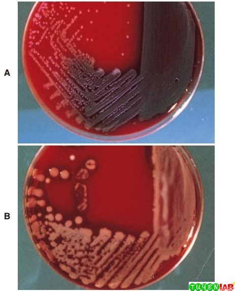 Microbiology Use Of Colonial Morphology For The Presumptive