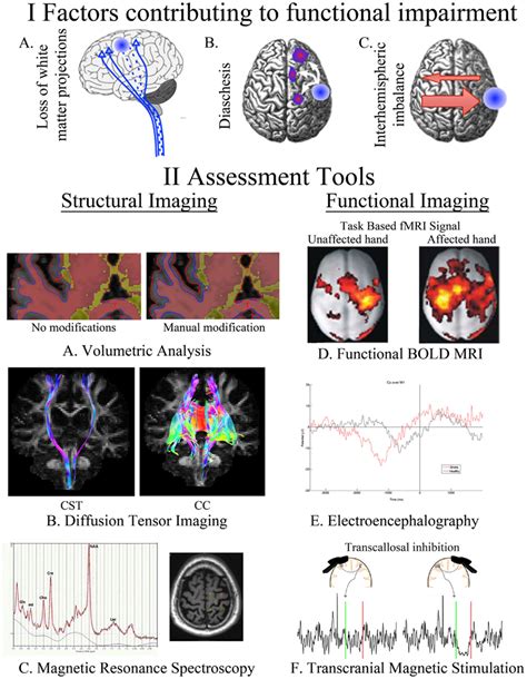 Frontiers A Review Of Transcranial Magnetic Stimulation And