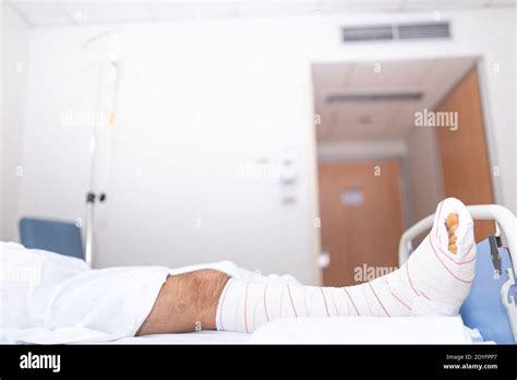 Patient Lying In Hospital Bed With Broken Leg Hospitalization And